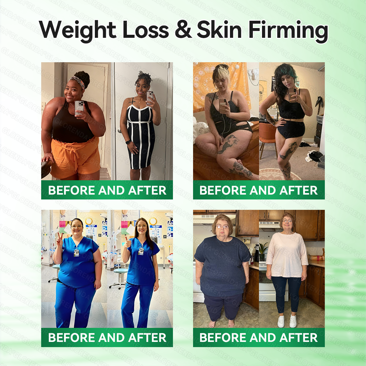 𝑶𝒇𝒇𝒊𝒄𝒊𝒂𝒍 𝑺𝒕𝒐𝒓𝒆  | 💖💖 𝐂𝐚𝐫𝐞𝐔𝐩𝐥𝐢𝐟𝐭® 𝙈𝒐𝒓𝒊𝒏𝒈𝗮 · 𝗕𝗲𝗿𝗯𝐞𝐫𝐢𝐧𝙚 × 𝙉𝑨𝑫+ 𝟏𝟎-𝙞𝙣-𝟏 𝘼𝒅𝒗𝒂𝒏𝒄𝒆𝐝 𝐍𝐚𝐧𝙤 𝙈𝙞𝙘𝙧𝙤𝙣𝒆𝒆𝒅𝒍𝐞 𝐏𝐚𝐭𝙘𝙝(𝐉𝐮𝐬𝐭 𝐨𝐧𝐜𝐞 𝐚 𝐝𝐚𝐲, 𝐯𝐢𝐬𝐢𝐛𝐥𝐞 𝐜𝐡𝐚𝐧𝐠𝐞𝐬 𝐢𝐧 𝟕 𝐝𝐚𝐲𝐬） ✅ 𝐅𝐨𝐫 𝐨𝐛𝐞𝐬𝐢𝐭𝐲, 🅛🅞🅞🅢🅔 🅢🅚🅘🅝,𝐝𝐢𝐚𝐛𝐞𝐭𝐞𝐬, 𝐬𝐥𝐞𝐞𝐩 𝐚𝐩𝐧𝐞𝐚, 𝐣𝐨𝐢𝐧𝐭 𝐢𝐬𝐬𝐮𝐞𝐬, 𝐚𝐧𝐝 𝐦𝐨𝐫𝐞